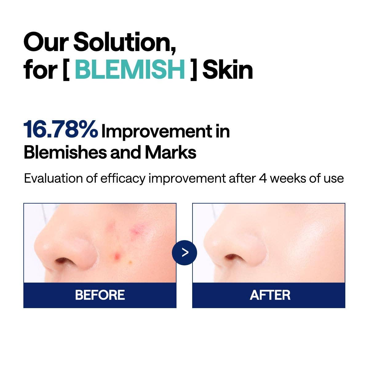 K-Beauty Direct - Mediheal Madecassoside Blemish Toner Pad – Almohadillas Veganas Calmantes con Centella Asiática para Piel Propensa al Acné | Venta al por Mayor de K-Beauty