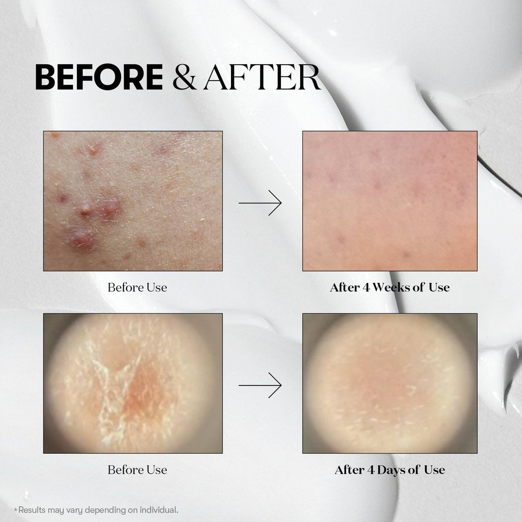 K-Beauty Direct - VT Cosmetics Reedle Shot 100 | Venta al por mayor de K-Beauty